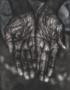 A picture of a persons open hands. This person is old and the picture shows the person had worked hard.